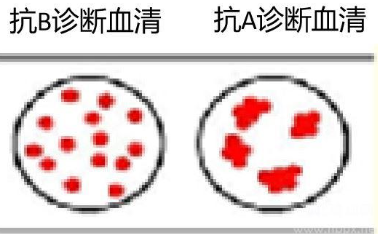 沛_dcd口试?png